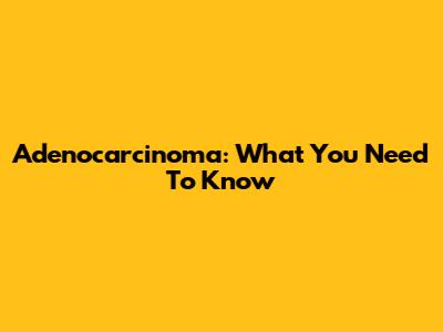 Adenocarcinoma: What You Need To Know