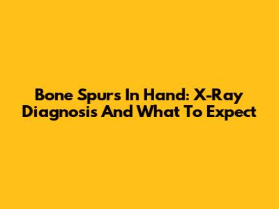 Bone Spurs In Hand: X-Ray Diagnosis And What To Expect