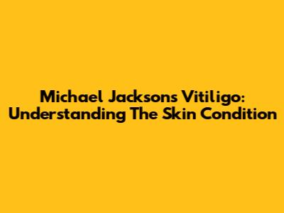 Michael Jackson's Vitiligo: Understanding The Skin Condition