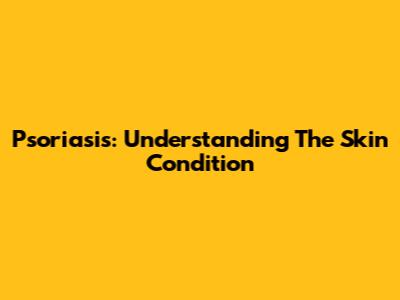 Psoriasis: Understanding The Skin Condition