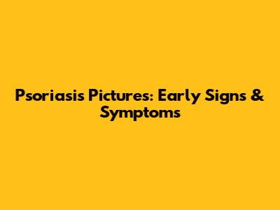 Psoriasis Pictures: Early Signs & Symptoms